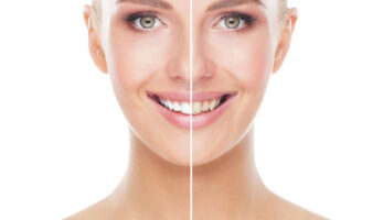 igiene dentale bergamo milano