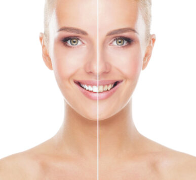 igiene dentale bergamo milano