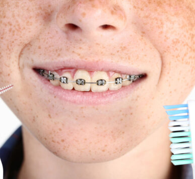 Ortodonzia di eccellenza a Milano e Bergamo