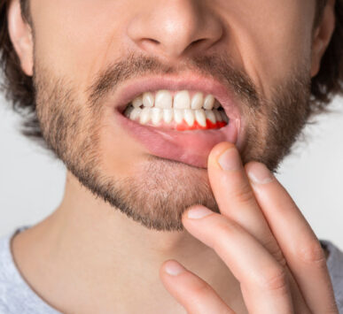 parodontologia di eccellenza monza milano brescia bergamo.